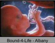 Bound-4-Life - Albany